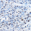 Developmental Biology Anti-NUDT21 Antibody CAB4482