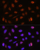 Epigenetics and Nuclear Signaling Antibodies 3 Anti-CSTF2T Antibody CAB4540