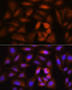 Cell Cycle Antibodies 1 Anti-NCAPH Antibody CAB4548