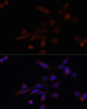 Cell Biology Antibodies 9 Anti-TMOD3 Antibody CAB4671