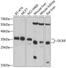 Metabolism Antibodies 2 Anti-DCXR Antibody CAB4721