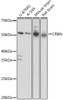 Signal Transduction Antibodies 2 Anti-CRBN Antibody CAB4722