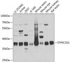 Cell Biology Antibodies 9 Anti-DYNC2LI1 Antibody CAB4752