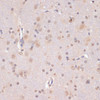 Cell Death Antibodies 2 Anti-PIDD Antibody CAB4831