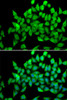 Cell Biology Antibodies 9 Anti-ALS2 Antibody CAB4895