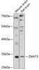 Cell Death Antibodies 2 Anti-ZMAT3 Antibody CAB4928
