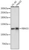 Immunology Antibodies 2 Anti-RBM15 Antibody CAB4936