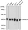 Immunology Antibodies 2 Anti-DNAJB14 Antibody CAB4990