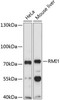 Epigenetics and Nuclear Signaling Antibodies 3 Anti-RMI1 Antibody CAB4991