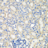 Cell Biology Antibodies 9 Anti-NAA50 Antibody CAB4996