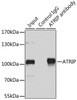 Epigenetics and Nuclear Signaling Antibodies 3 Anti-ATRIP Antibody CAB5041