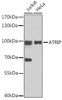 Epigenetics and Nuclear Signaling Antibodies 3 Anti-ATRIP Antibody CAB5041