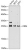 Metabolism Antibodies 2 Anti-CBR4 Antibody CAB5069