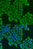 Cell Biology Antibodies 9 Anti-ATPIF1 Antibody CAB5099