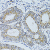 Cell Biology Antibodies 9 Anti-DNAJC19 Antibody CAB5146