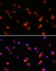 Cell Biology Antibodies 9 Anti-ARL13B Antibody CAB5200