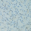 Epigenetics and Nuclear Signaling Antibodies 3 Anti-GTF2H2C Antibody CAB5239