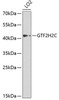 Epigenetics and Nuclear Signaling Antibodies 3 Anti-GTF2H2C Antibody CAB5239