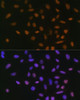 Cell Biology Antibodies 9 Anti-Snail Antibody CAB5243