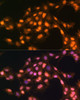 Cell Biology Antibodies 9 Anti-Snail Antibody CAB5243