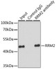 Epigenetics and Nuclear Signaling Antibodies 3 Anti-RRM2 Antibody CAB5255