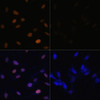Cell Biology Antibodies 9 Anti-Acetyl-Histone H4-K16 Antibody CAB5280