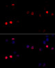 Cell Cycle Antibodies 1 Anti-Cyclin G1 Antibody CAB5292