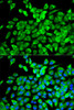 Immunology Antibodies 2 Anti-EIF4A1 Antibody CAB5294