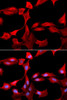 Metabolism Antibodies 2 Anti-GCLM Antibody CAB5314