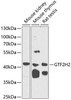 Epigenetics and Nuclear Signaling Antibodies 3 Anti-GTF2H2 Antibody CAB5317