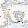 Cell Biology Antibodies 9 Anti-NOV Antibody CAB5320