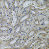 Developmental Biology Anti-SERPINE2 Antibody CAB5329