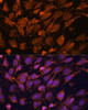 Metabolism Antibodies 2 Anti-ACAT1 Antibody CAB5335