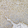 Cardiovascular Antibodies Anti-EFNA1 Antibody CAB5341