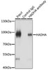 KO Validated Antibodies 1 Anti-HADHA Antibody CAB5346KO Validated