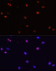 Epigenetics and Nuclear Signaling Antibodies 3 Anti-HDGF Antibody CAB5347