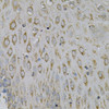 Cell Cycle Antibodies 1 Anti-NEK2 Antibody CAB5355