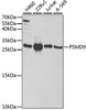 Cell Biology Antibodies 9 Anti-PSMD9 Antibody CAB5357