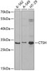 Cell Biology Antibodies 9 Anti-CTSH Antibody CAB5368