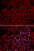 Immunology Antibodies 2 Anti-CUL5 Antibody CAB5369