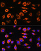 Cell Biology Antibodies 9 Anti-ADAM9 Antibody CAB5388