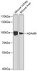 Cell Biology Antibodies 9 Anti-ADAM9 Antibody CAB5388