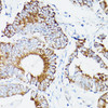 Cell Biology Antibodies 9 Anti-DLD Antibody CAB5403