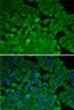 KO Validated Antibodies 1 Anti-EEF2K Antibody CAB5404KO Validated