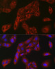 Metabolism Antibodies 2 Anti-FBP1 Antibody CAB5406