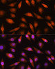 Cell Biology Antibodies 9 Anti-LIMK2 Antibody CAB5409