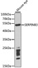 Cell Biology Antibodies 9 Anti-SERPINB3 Antibody CAB5418
