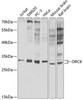 Epigenetics and Nuclear Signaling Antibodies 3 Anti-ORC6 Antibody CAB5426