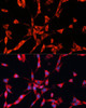 Metabolism Antibodies 2 Anti-GARS Antibody CAB5435