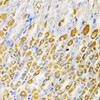 Cell Cycle Antibodies 1 Anti-RPS6KA3 Antibody CAB5436